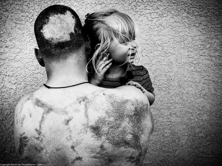 Everyone should see these powerful images of wounded vets