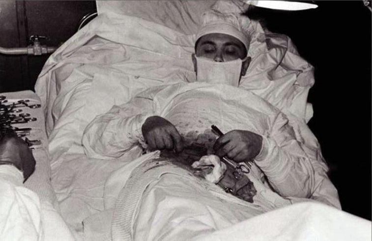 You will never be as badass as this explorer who removed his own appendix
