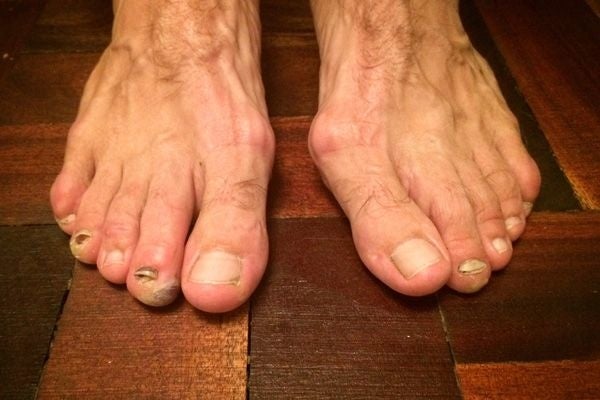 Here’s why your feet hurt all the damn time!