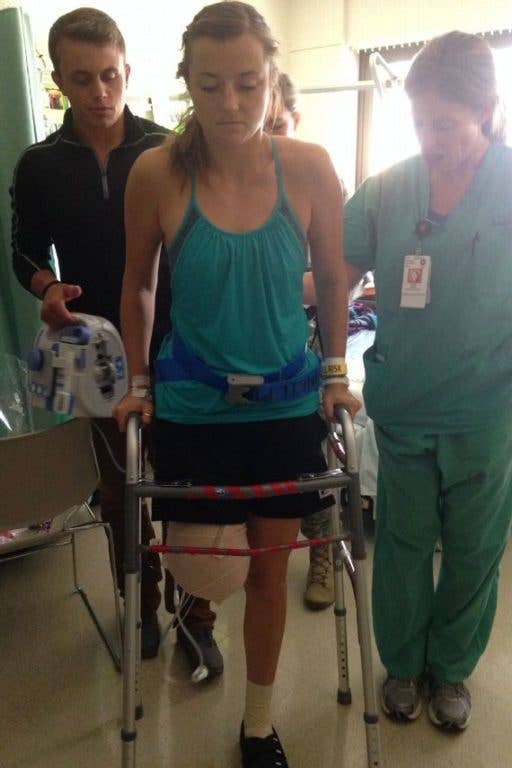U.S. Air Force Capt. Christy Wise, early after losing her leg during a boating accident. (courtesy photo of the Wise family)
