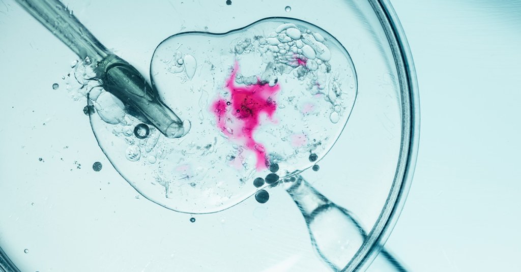 Close-up of in vitro fertilization process with vivid colors