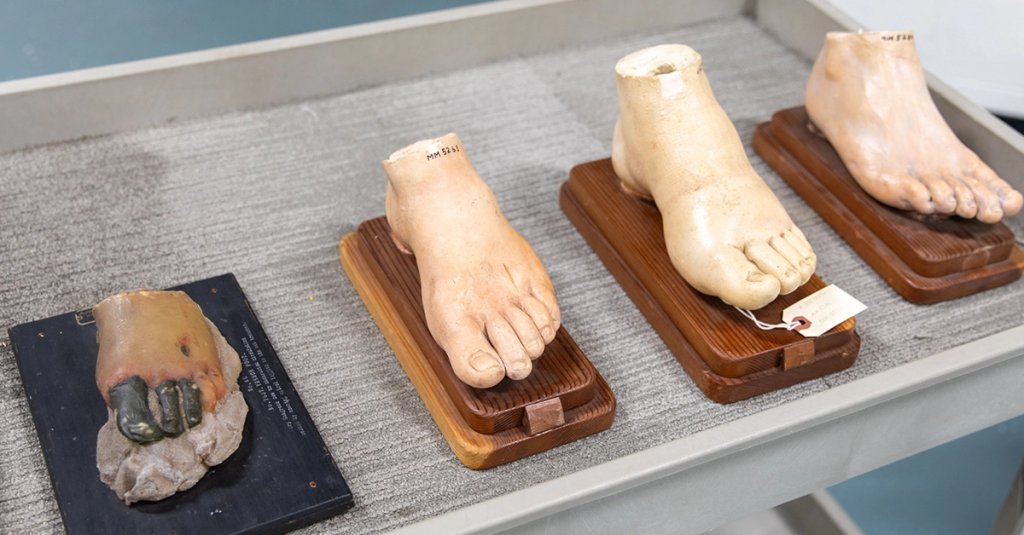 battle buddy trench foot models museum of health