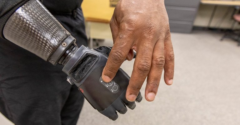 Neural-Enabled Prosthetic Hand neph dod