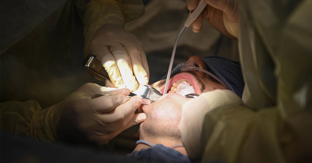 wisdom teeth extraction USAF